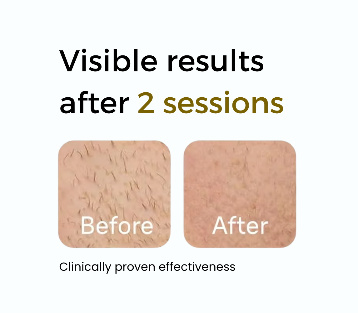 BeautAlys – Permanent Body & Facial Hair Removal